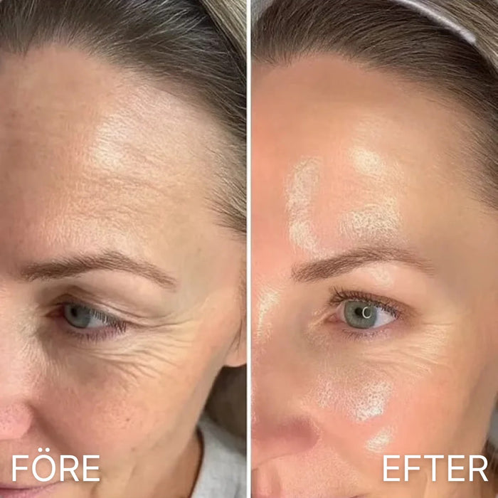Så köper du SVEA SKIN® PDRN Volufiline Collagen Balm